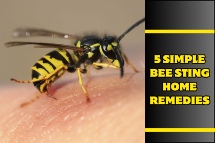 5 Simple Bee Sting Home Remedies